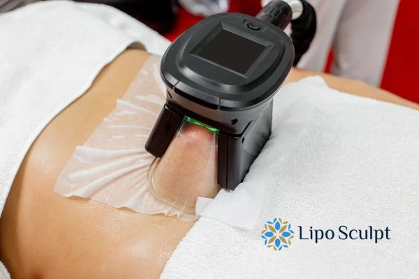 Does Fat Freezing at Home Work? DIY Devices vs Professional Cryolipolysis 1 How is professional cryolipolysis different Livingston?