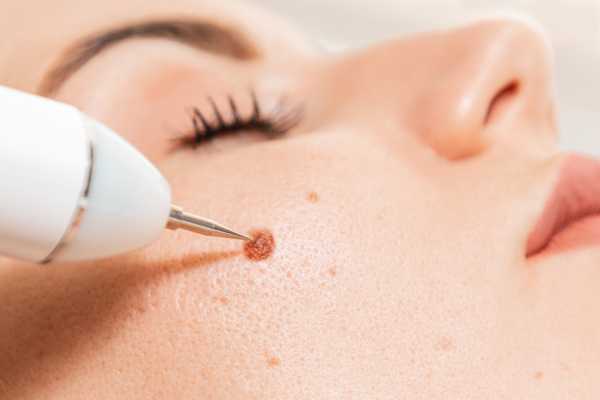 Questions to ask before treatment