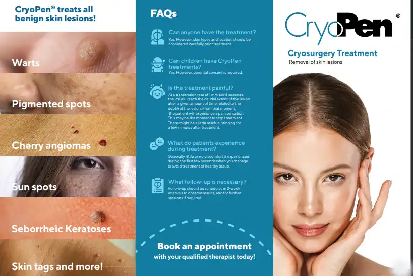 Benefits of Cryopen for seborrheic keratosis Removal Treatment Livingston